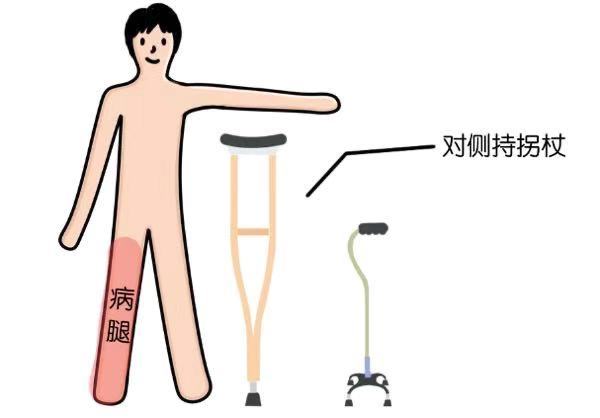 拐杖的“左右為難”——您會正確使用拐杖嗎？(圖2)
