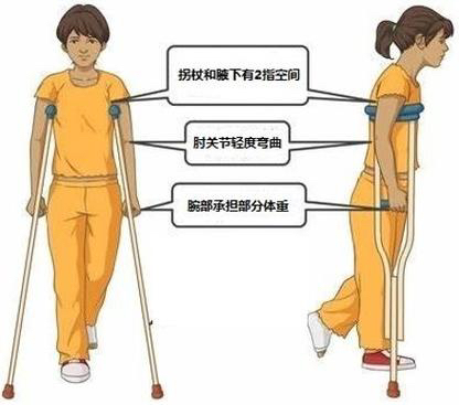 拐杖的“左右為難”——您會正確使用拐杖嗎？(圖4)
